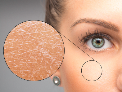 Laser hair removal treatment