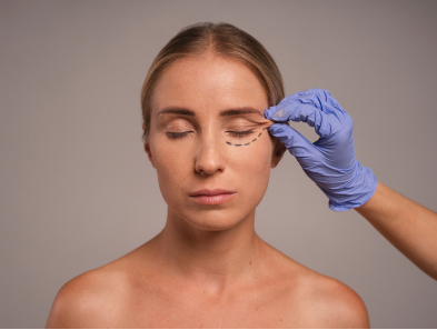 Laser hair removal treatment