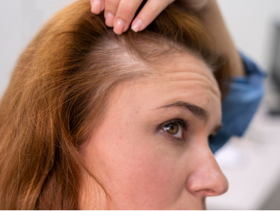 Laser hair removal treatment
