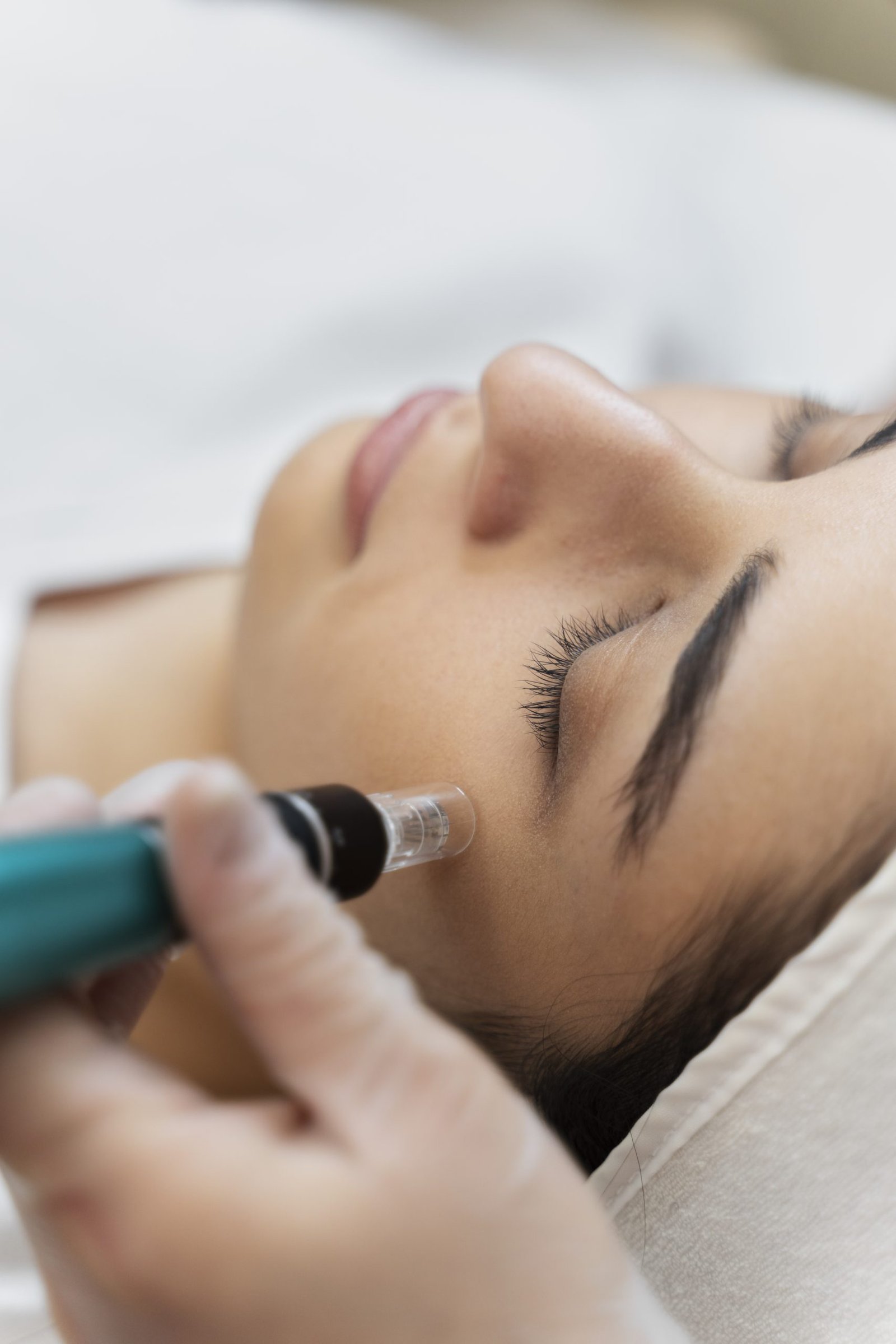 Skin Rejuvenation